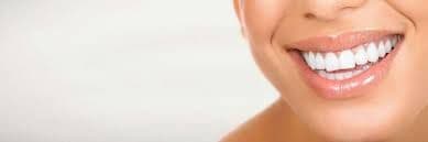 Bright white smile after treatment